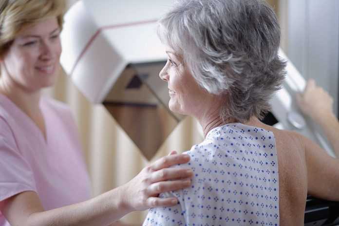 Primeras pautas de mamografía publicadas para sobrevivientes de cáncer de mama de 75 años o más


